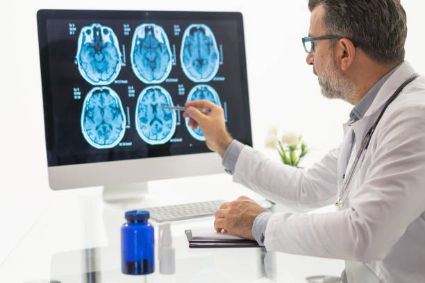 Neurologist reviewing brain health scan